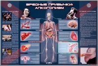 Электрифицированный стенд "Вредные привычки: алкоголизм" - «globural.ru» - Клин