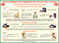 Таблица Порядок действий при опасном кровотечении 1000*1400 винил - «globural.ru» - Клин