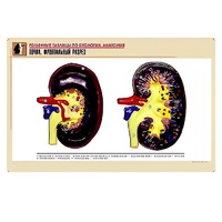 Рельефная таблица "Почка. Фронтальный разрез" (формат А1, матовое ламинир.) - «globural.ru» - Клин
